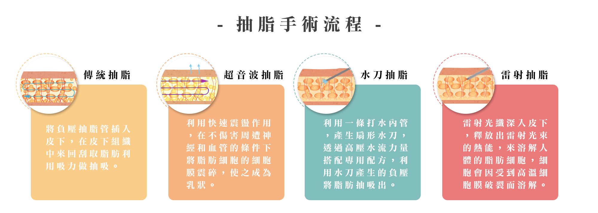 抽脂手術流程