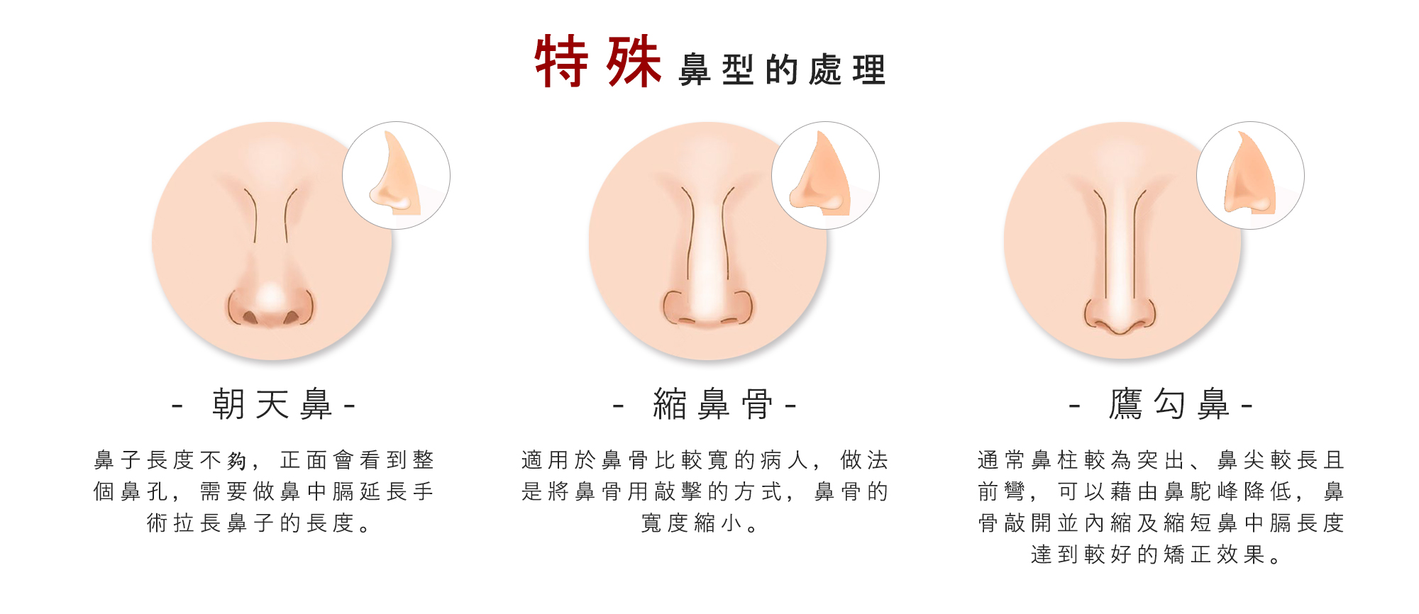 特殊鼻型的處理