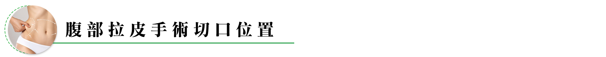 腹部拉皮手術切口位置  局部的微創腹部拉皮